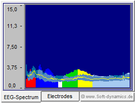 Neurofeedback - eBioo Amplitude