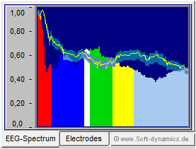 Neurofeedback - eBioo Coherence