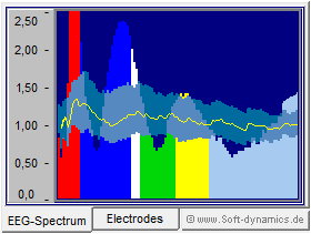 Neurofeedback - eBioo rel.Amplitude